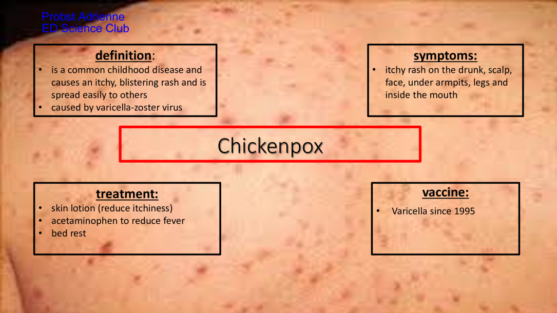 CHICKENPOX-%E2%80%93-ONE-OF-THE-MOST-CHILDHOOD-DISEASES-Probst-Adrienne2-d968eeb5.png