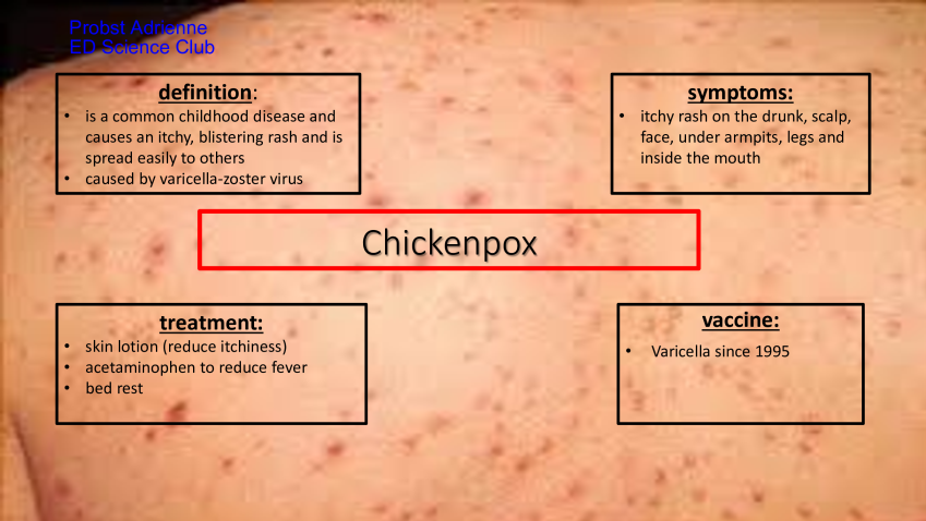 CHICKENPOX-%E2%80%93-ONE-OF-THE-MOST-CHILDHOOD-DISEASES-Probst-Adrienne-676df5cc.png