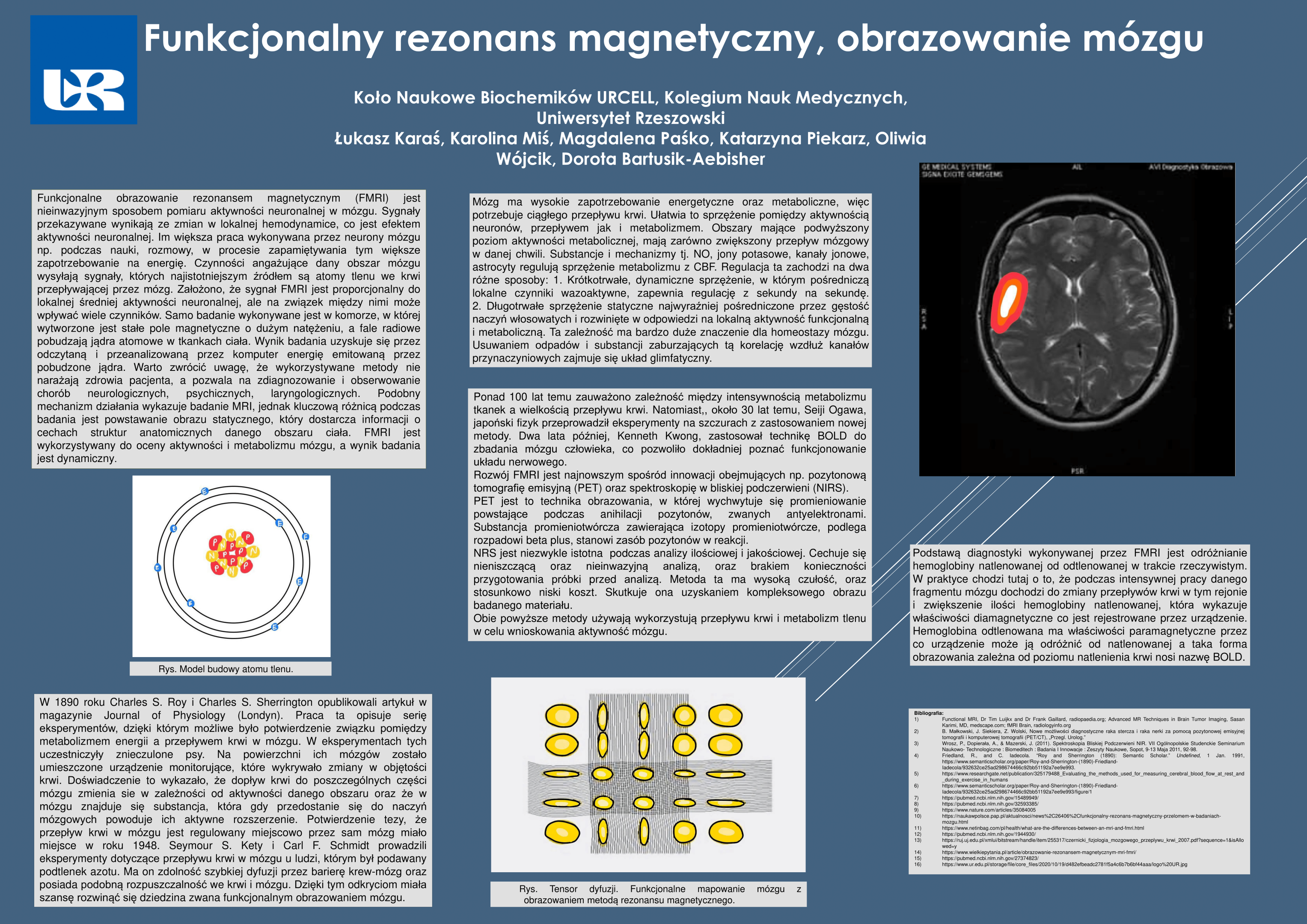 Funkcjonalny-rezonans-magnetyczny-obrazowanie-mozgu - UR Cell Biochemistry Student Scientific Circle